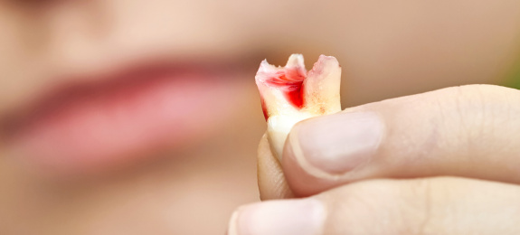 A tejfogak cseréjének ideje